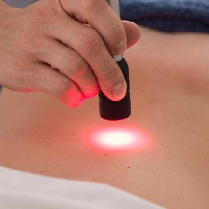 Laser-terapia